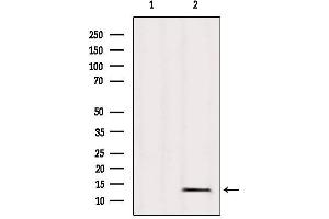 Western blot analysis of extracts from Mouse heart, using L36mt Antibody. (MRPL36 anticorps  (Internal Region))