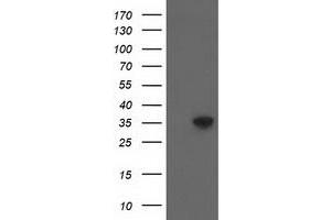 Western Blotting (WB) image for anti-Aminoacylase 3 (ACY3) antibody (ABIN1496462) (Aminoacylase 3 anticorps)
