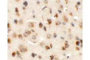 Immunohistochemical staining of mouse brain cells with AP3M1 polyclonal antibody  at 5 ug/mL. (AP3M1 anticorps  (C-Term))