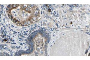 ABIN6279398 at 1/100 staining Human prostate tissue by IHC-P. (RNF41 anticorps  (Internal Region))