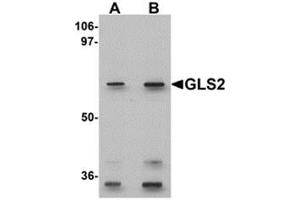 Western blot analysis of GLS2 in rat kidney tissue lysate with GLS2 antibody at (A) 0. (GLS2 anticorps  (Center))