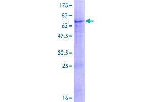 Image no. 1 for Tubulin tyrosine Ligase-Like Family, Member 9 (TTLL9) (AA 1-347) protein (GST tag) (ABIN1324071)