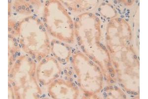 Detection of ODC in Human Kidney Tissue using Polyclonal Antibody to Ornithine Decarboxylase (ODC)