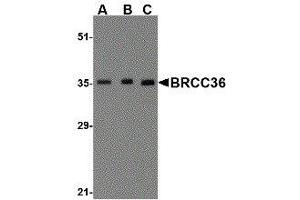 Western Blotting (WB) image for anti-BRCA1/BRCA2-Containing Complex, Subunit 3 (BRCC3) (N-Term) antibody (ABIN2477712) (BRCC3 anticorps  (N-Term))