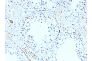 Formalin-fixed, paraffin-embedded human Testis stained with Wilm's Tumor Mouse Monoclonal Antibody (6F-H2). (WT1 anticorps  (AA 1-181))