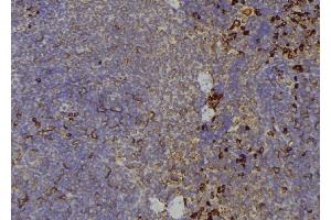 ABIN6267197 at 1/100 staining Human lymph node tissue by IHC-P.