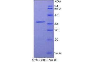 SDS-PAGE analysis of Rat aZGP1 Protein. (AZGP1 Protéine)
