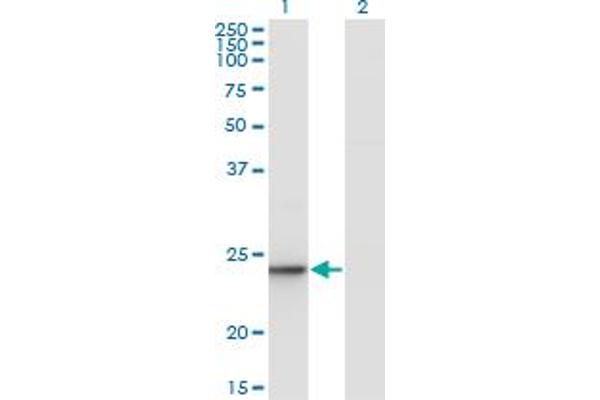 Ube2t antibody  (AA 1-197)