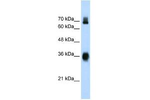 Western Blot showing KEAP1 antibody used at a concentration of 1-2 ug/ml to detect its target protein. (KEAP1 anticorps  (C-Term))