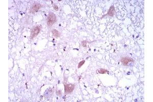 Immunohistochemical analysis of paraffin-embedded brain tissues using DKK3 mouse mAb with DAB staining.