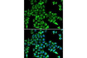 Immunofluorescence (IF) image for anti-Cystatin C (CST3) antibody (ABIN3022135)