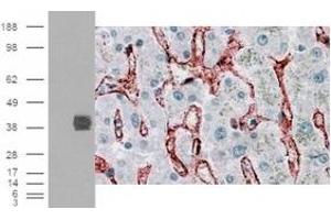 Immunohistochemistry (IHC) image for anti-Fc gamma RII (CD32) (C-Term) antibody (ABIN2465516) (Fc gamma RII (CD32) (C-Term) anticorps)