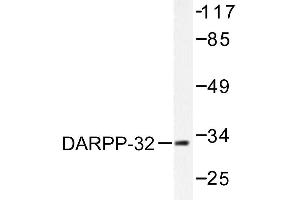 Image no. 1 for anti-Protein Phosphatase 1, Regulatory (Inhibitor) Subunit 1B (PPP1R1B) antibody (ABIN271882) (DARPP32 anticorps)