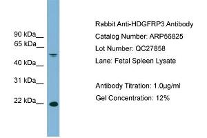 WB Suggested Anti-HDGFRP3  Antibody Titration: 0. (HDGFRP3 anticorps  (Middle Region))