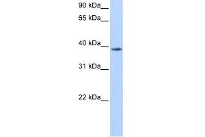 WB Suggested Anti-NUDT13 Antibody Titration:  0. (NUDT13 anticorps  (N-Term))
