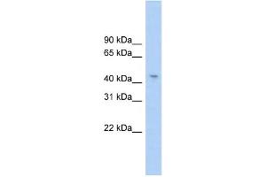 WB Suggested Anti-RG9MTD1 Antibody Titration:  0. (RG9MTD1 anticorps  (Middle Region))