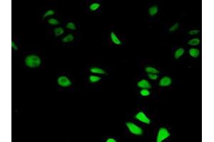 IHC-P analysis of Human HeLa cells, with FITC staining. (HIF1AN anticorps  (AA 2-349))