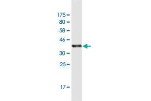 Western Blot detection against Immunogen (37.