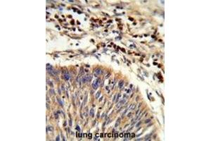 Immunohistochemistry (IHC) image for anti-Heat Shock 70kDa Protein 6 (HSP70B') (HSPA6) antibody (ABIN3003879)