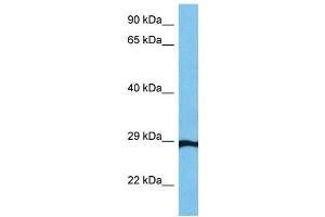 Host:  Mouse  Target Name:  GTF2F2  Sample Tissue:  Mouse Small Intestine  Antibody Dilution:  1ug/ml (GTF2F2 anticorps  (Middle Region))