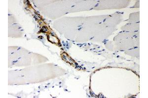 Anti- BAK Picoband antibody, IHC(P) IHC(P): Rat Skeletal Muscle Tissue