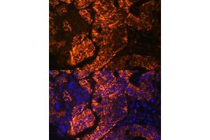 Immunofluorescence analysis of human colon carcinoma cells using TNFRSF25 antibody (ABIN7271071) at dilution of 1:100.