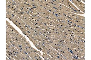 ABIN6263014 and ABIN6278668 at 1/100 staining rat heart tissue by IHC-P.