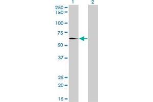 Western Blot analysis of EHD2 expression in transfected 293T cell line by EHD2 monoclonal antibody (M01), clone 2D8. (EHD2 anticorps  (AA 365-427))