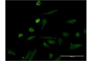 Immunofluorescence of monoclonal antibody to IL1A on HeLa cell.