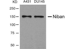 Western blot analysis of extracts from A431 and DU145 cells using Niban Antibody. (Niban anticorps)