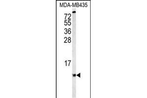 Western blot analysis of COX6A1 Antibody (Center) (ABIN653100 and ABIN2842691) in MDA-M cell line lysates (35 μg/lane). (COX6A1 anticorps  (AA 50-78))