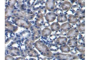 DAB staining on IHC-P; Samples: Mouse Kidney Tissue