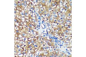 Immunohistochemistry of paraffin-embedded Rat liver using PYCR2 Rabbit pAb (ABIN7269766) at dilution of 1:100 (40x lens). (PYCR2 anticorps  (AA 271-320))