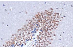 Immunohistochemistry of paraffin-embedded Mouse brain using DNMT3L Polyclonal Antibody at dilution of 1:100 (40x lens).