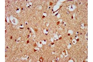 IHC image of ABIN7150918 diluted at 1:500 and staining in paraffin-embedded human brain tissue performed on a Leica BondTM system. (KIAA0319 anticorps  (AA 153-268))