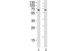 YY1 antibody western blot analysis in Daudi and U251 lysate.