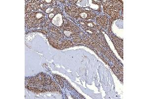 IHC analysis of TRMT61A using anti-TRMT61A antibody (ABIN7599220). (TRMT61A anticorps  (AA 1-289))