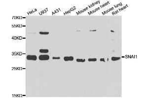 Western blot analysis of extracts of various cell lines, using SNAI1 antibody. (SNAIL anticorps)