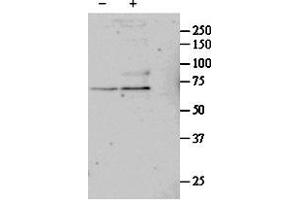 ABIN571032 (1µg/ml) staining of untreated (first lane) and TGF-bl-treated (second lane) primary cultured Human Lung fibroblast lysate. (SRF anticorps  (Internal Region))