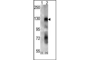 Western blot analysis of EphA6 (arrow) using rabbit polyclonal EphA6 Antibody. (EPH Receptor A6 anticorps)