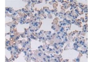 Detection of a1ACT in Mouse Lung Tissue using Polyclonal Antibody to Alpha-1-Antichymotrypsin (a1ACT) (a1-Antichymotrypsin (AA 23-253) anticorps)