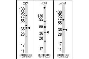 Western blot analysis of anti-HIF1AN Pab in 293, HL60 and Jurkat cell line lysates (HIF1AN anticorps  (N-Term))