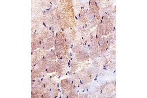 Immunohistochemical analysis of paraffin-embedded H. (Hexokinase 2 anticorps  (AA 453-483))