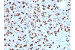 Formalin-fixed, paraffin-embedded human Pancreas stained with BARX1 Mouse Monoclonal Antibody (BARX1/2760). (BARX1 anticorps)