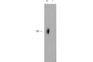 Western blot testing of immunoprecipitate from a lysate of human natural killer cells with (+) or without (-) pervanadate treatment of the cells using phospho-CD244 antibody at 2ug/ml. (2B4 anticorps)