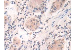 Detection of IFI30 in Human Stomach Tissue using Polyclonal Antibody to Interferon Gamma Inducible Protein 30 (IFI30)