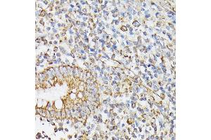 Immunohistochemistry of paraffin-embedded human appendix using RHOG antibody (ABIN7269864) at dilution of 1:100 (40x lens).