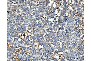 IHC analysis of THBS3 using anti-THBS3 antibody (ABIN7600759).