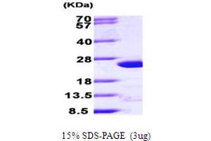 SDS-PAGE (SDS) image for ADP-Ribosylation Factor 4 (ARF4) (AA 1-180) protein (His tag) (ABIN666652)