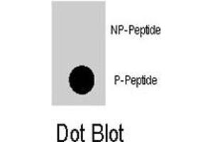 Dot blot analysis of PDPK1 (phospho S396) polyclonal antibody  on nitrocellulose membrane. (PDPK1 anticorps  (pSer396))